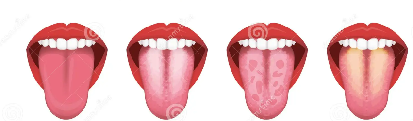 Raspador de língua